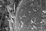 This scanning electron micrograph (SEM) depicted a