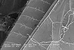 This scanning electron micrograph (SEM) depicted a