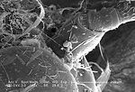 This scanning electron micrograph (SEM) depicted a