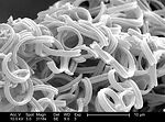 This scanning electron micrograph (SEM), highly ma