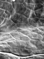 This electron micrograph reveals the textured surf