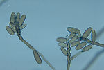 This photomicrograph shows conidiophores and conid