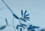 This photomicrograph shows a conidia-laden conidio