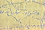 This photomicrograph reveals the microconidia of t