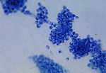 This is a photomicrograph of the fungus Candida al