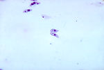 Leishmania donovani, leptomonad forms.  Parasite.