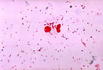 This is a photomicrograph of Neisseria gonorrhoeae