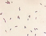 Clostridium botulinum spores stained with Malachit