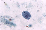 Entamoeba coli trophozoite with ingested bacteria.