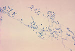 This is a photomicrograph of the fungus Microsporu