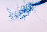 This is a photomicrograph of the fungus Microsporu