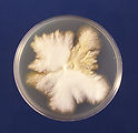 This image is a plate culture of the fungus Tricho