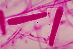 This photomicrograph depicts the microconidia of t