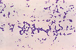 Photomicrograph of spherical (cocci) Gram-positive