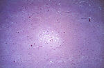 This photomicrograph revealed some of the cytoarch