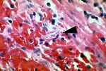 This micrograph reveals a Strongyloides stercorali