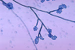 This photomicrograph reveals the conidiophores of 