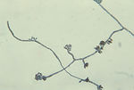 This is a micrograph depicting the fungus Hortaea 