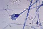 This photomicrograph reveals a mature sporangium o