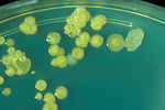 This is a trypticase soy agar plate culture of E. 