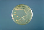 This is a trypticase soy agar plate culture of Ent