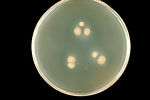 This agar plate culture of the fungus Sporothrix s