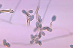 This photomicrograph shows a condiophore with coni