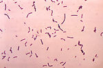 Bacillus brevis.  Gram stain.