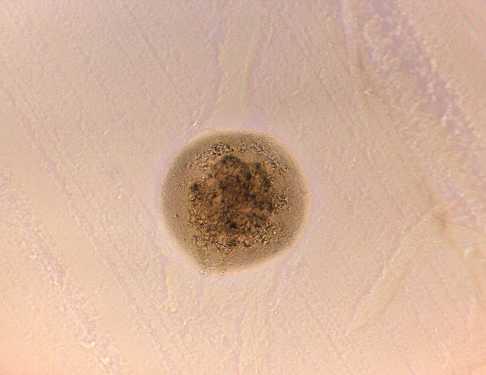 Magnified 125X, this image depicts the morphologic characteristics displayed by a single Gram-positive, Actinomyces bovis bacterial microcol