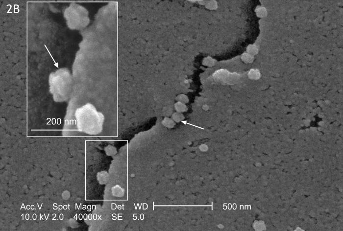 This SEM of SARS-infected Vero E6 cells reveals the protrusion of 'knobby', 'rosettelike' viruses from the cells' edges.