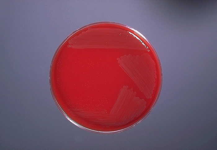 Blood agar plate culture of Campylobacter fetus s. intestinalis.