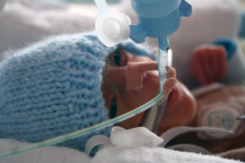 Premature twin's fight for life leaves lasting legacy