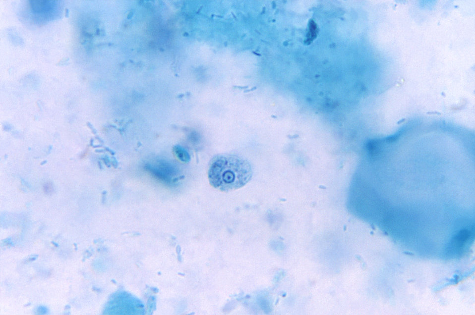 Entamoeba hartmanni trophozoite.