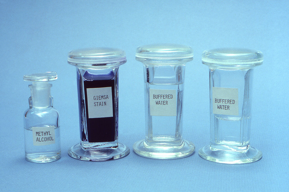 This 1981 photograph depicted a few of the laboratory materials integral in the fixation of thin blood films by using the Giemsa staining pr