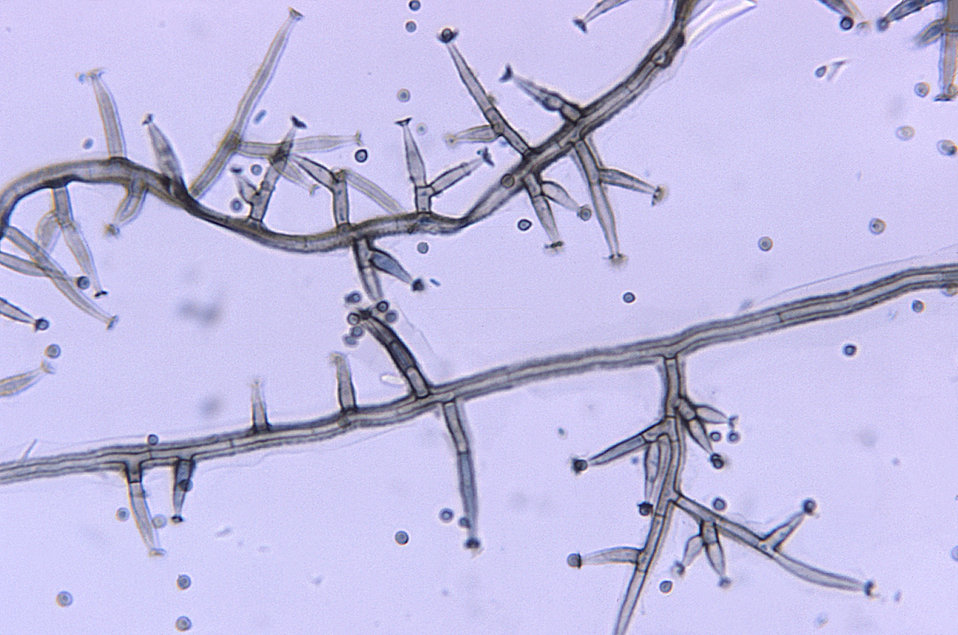 Magnified 500X, this photomicrograph revealed some of the ultrastructural morphology displayed by the dematiaceous (pigmented) filamentous f