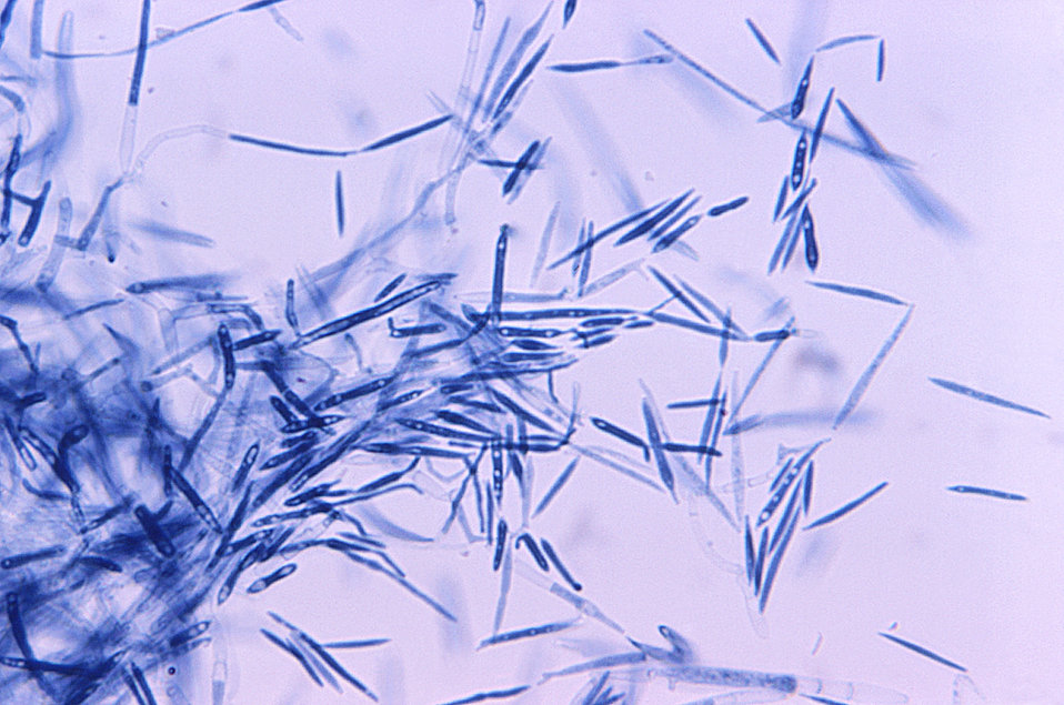 Magnified 500X, this photomicrograph revealed some of the ultrastructural morphology displayed by the smut fungus, Ustilago maydis. In this 