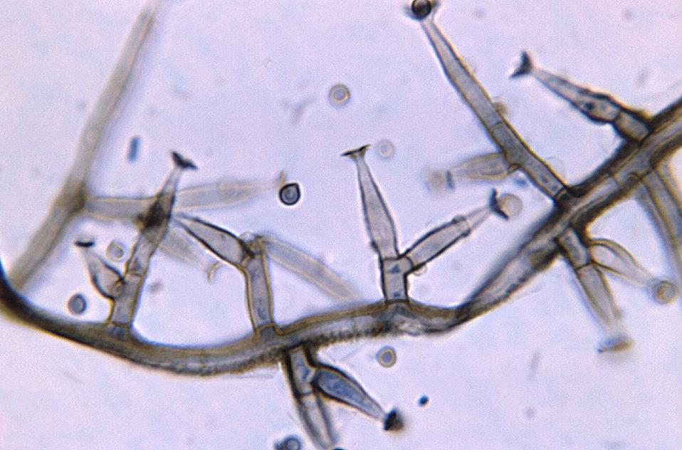 Magnified 1125X, this photomicrograph revealed some of the ultrastructural morphology displayed by the dematiaceous (pigmented) filamentous 