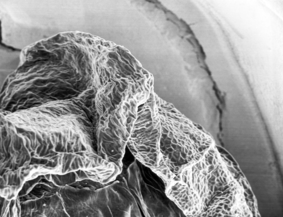 This electron micrograph reveals the textured surface of a blackberry Rubus villosus.