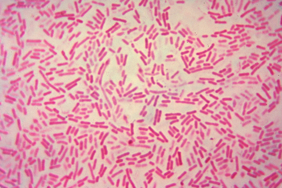 This micrograph depicts Bacteroides hypermegas bacteria cultured in blood agar medium for 48 hours.