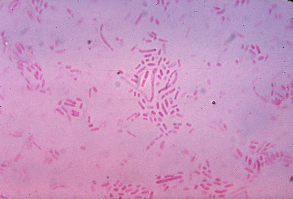 This photomicrograph shows gram-negative Actinobacillus ureae, formerly Pasteurella ureae bacteria grown in a culture medium for 24 hours.