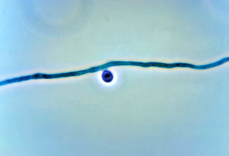 This photomicrograph shows a conidiophore with an attached conidium of the fungus Pseudallescheria boydii.