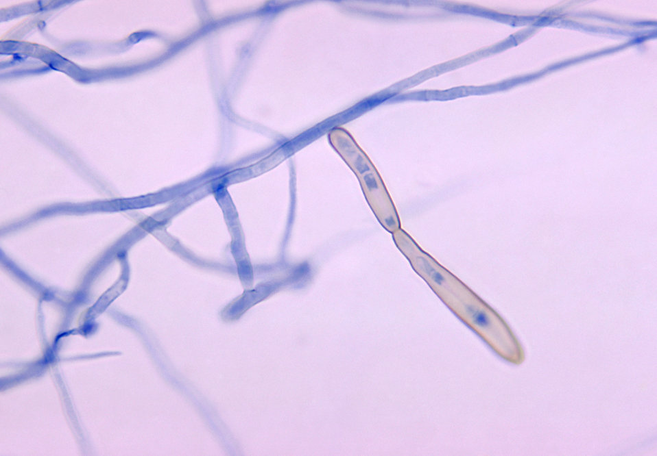 This photomicrograph shows the conidia of the fungus Corynespora cassiicola.