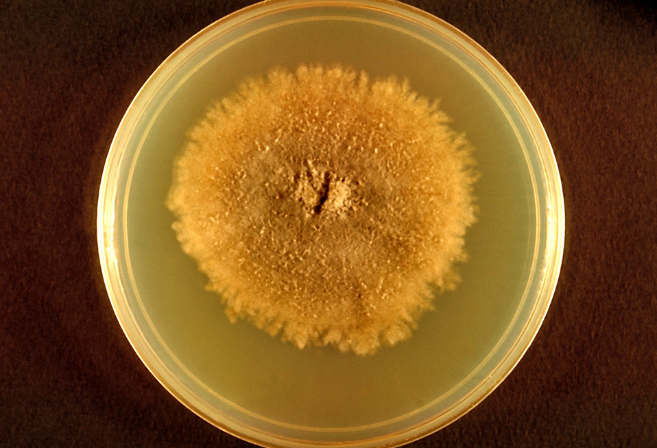 Public Domain Picture This Image Depicts A Plate Culture Containing A public-domain-picture-this-image-depicts-a-plate-culture-containing-a