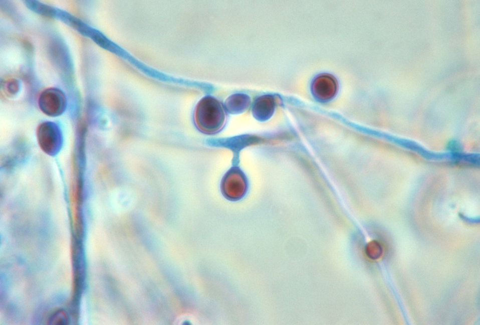 This photomicrograph shows a conidiophore with a number of conidia of the fungus Pseudallescheria boydii.