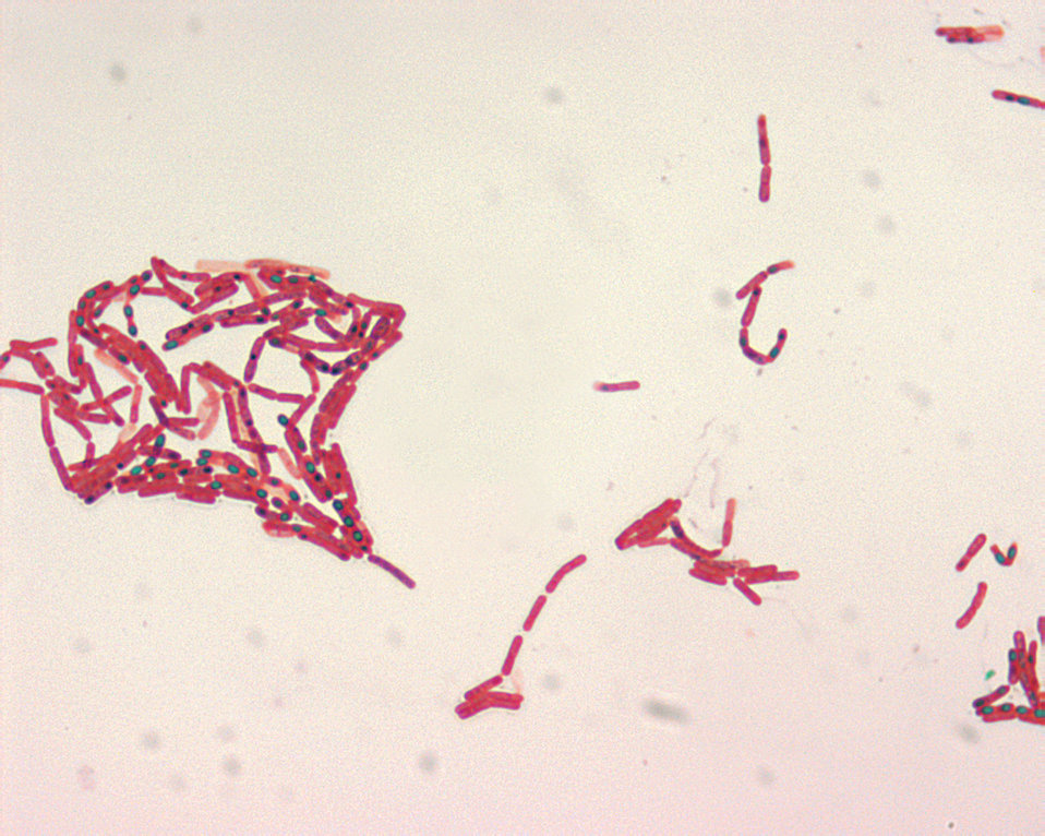  Bacillus spp. Malachite Green spore stain.