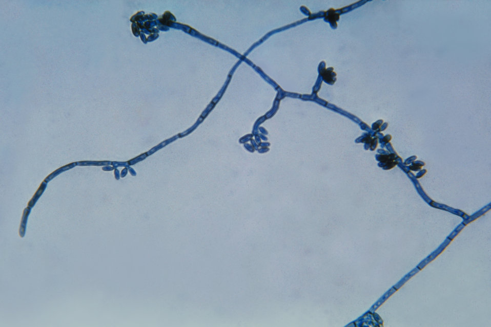 This is a photomicrograph of the fungus Hortaea werneckii, the causative agent of Tinea Nigra.