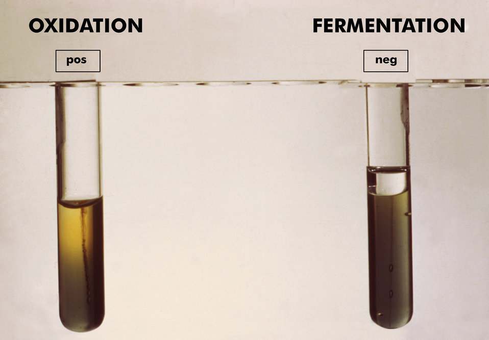 These Enterobacteriaceae cultures show positive oxidation, and negative fermentation reactivity in glucose medium.