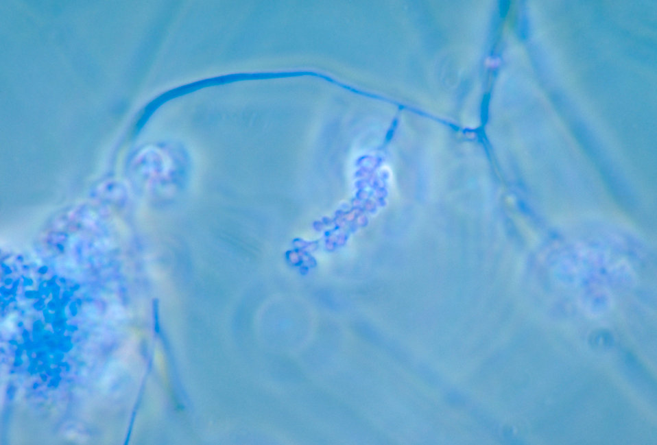 This is a photomicrograph of young conidiophores of a Tritirachium sp. fungus.