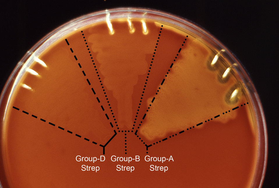 This image depicts the quantitative difference in hemolytic reactivity seen in a trypticase soy agar culture plate containing 5% sheep's blo