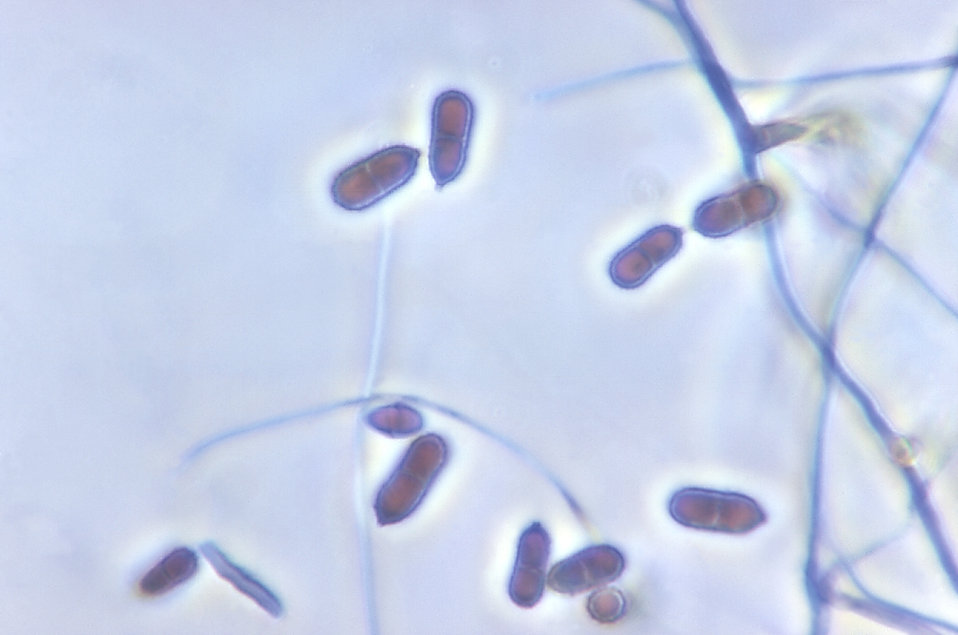 Magnified 1125X, this photomicrograph depicted a number of conidiophores, along with numbers of accompanying two-celled conidia of Ochroconi